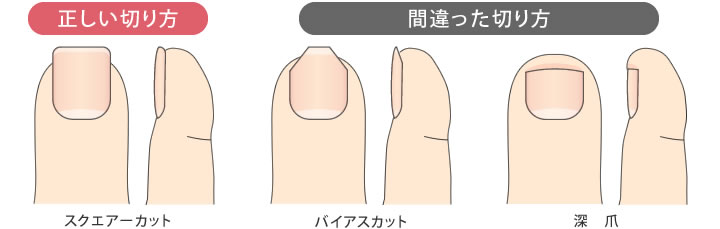 正しい爪の切り方はスクエアーカット